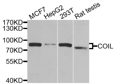 COIL / Coilin Antibody