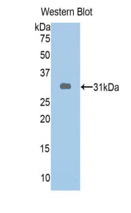 ABCA1 Antibody (aa1404-1663)