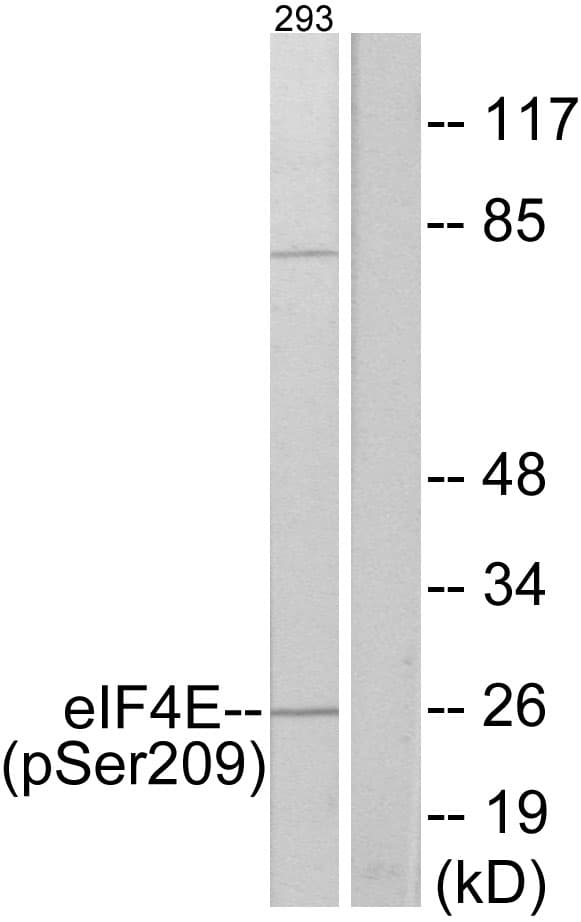 EIF4E Antibody (phospho-Ser209)