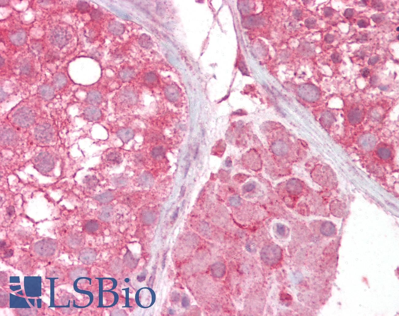 IHC-plus™ SLC16A7 / MCT2 Antibody (aa465-478)