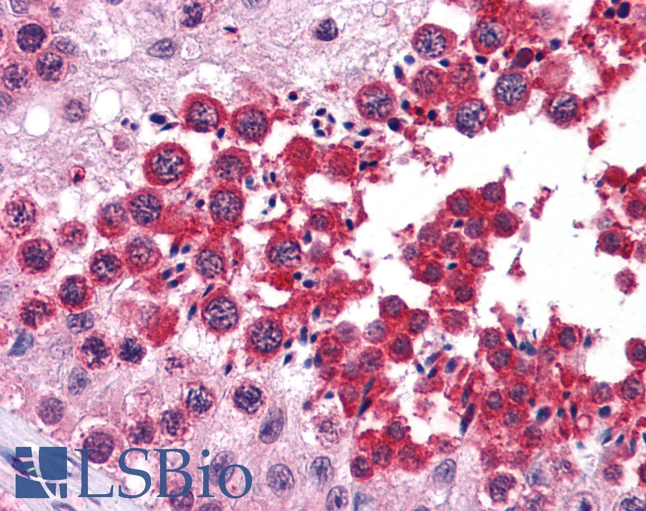 IHC-plus™ TIP48 / RUVBL2 Antibody