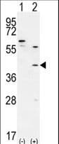 TGIF1 Antibody (aa145-174)