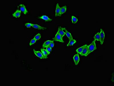 GRM1 / MGLUR1 Antibody