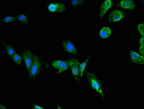 PAFAH1B1 / LIS1 Antibody