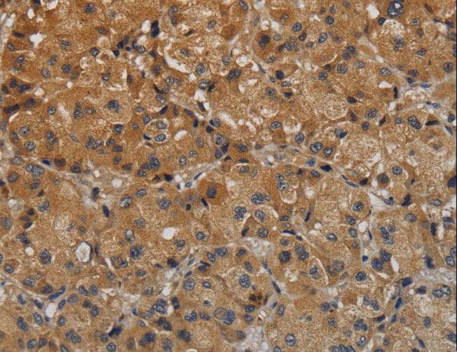 TAB1 Antibody