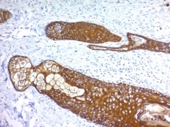 Basic Cytokeratin Antibody (clone KRTH/1076)