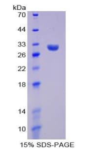 Pig TNNT2 / CTNT Protein (Recombinant His-T7)