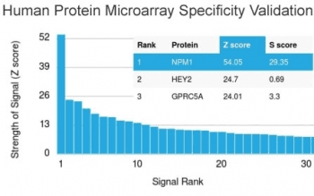 NPM1 / NPM / Nucleophosmin Antibody (clone NPM1/1902)
