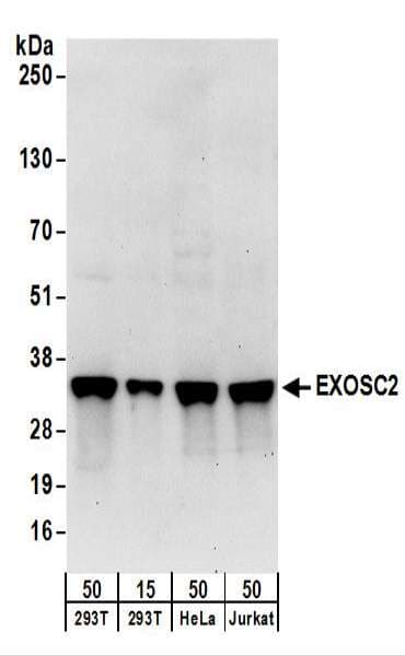Polyclonal Rabbit anti-Human EXOSC2 / RRP4 Antibody (aa243-293, WB)
