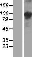 Human COMP / THBS5 Protein (Over-Expression Lysate Myc-DDK (Flag))