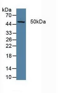 ERCC5 / XPG Antibody (aa778-986)
