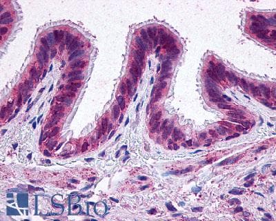 PathPlus™ PTGER2 / EP2 Antibody (N-Terminus)