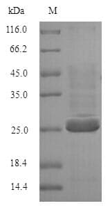 Human BTN3A2 Protein (Recombinant 6His, N-terminus)