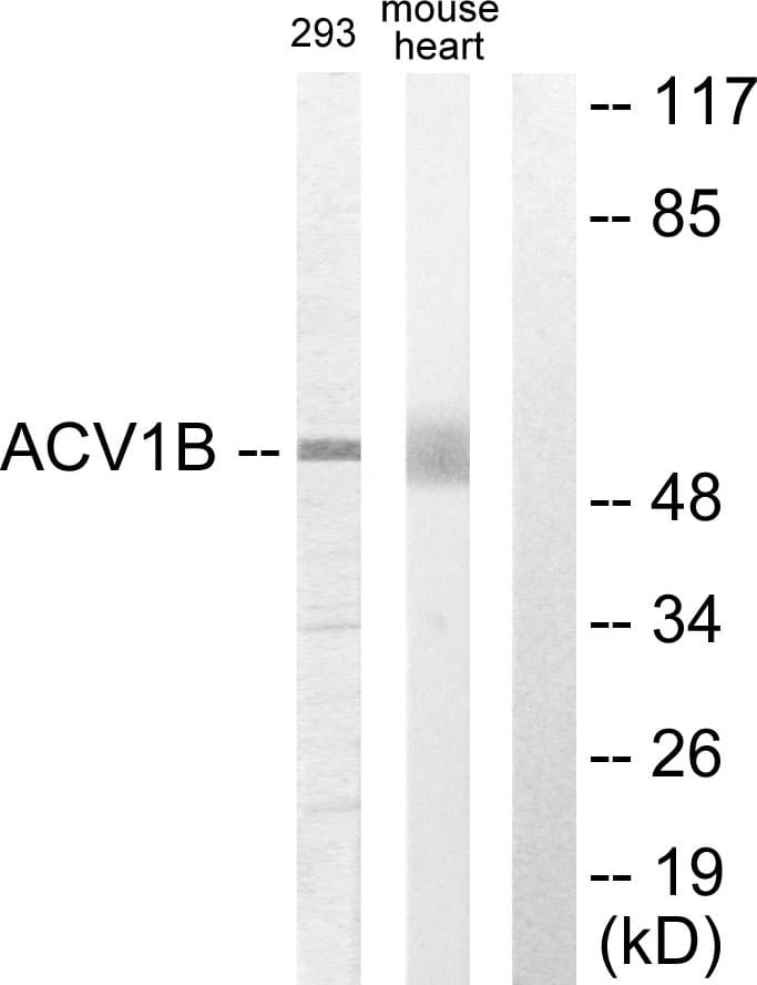 ACVR1B / ALK4 Antibody (aa73-122)