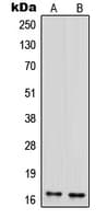 Polyclonal Rabbit anti-Human IFIH1 / MDA5 Antibody (C-Terminus, IHC, IF, WB)