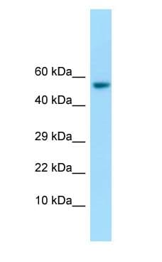 IFIT1 / ISG56 Antibody (aa270-319)