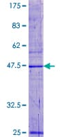 Human HSPC004 / POP5 Protein (Recombinant GST)