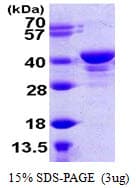 Human UCHL5 / UCH37 Protein (Recombinant His)