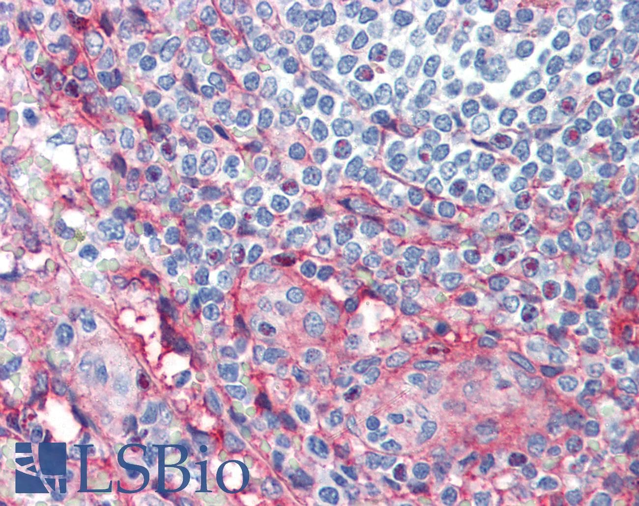 IHC-plus™ ICAM-1 / CD54 Antibody (clone 15.2)