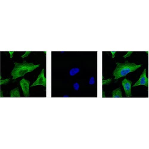 Beta Tubulin Antibody (C-term, clone M7)