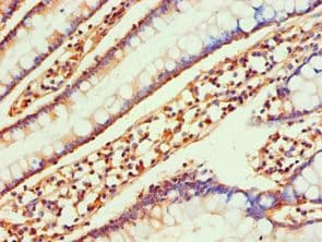CCL25 / TECK Antibody (aa24-150)