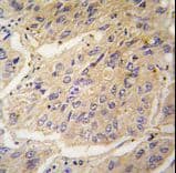 Polyclonal Rabbit anti-Human CASP3 / Caspase 3 Antibody (aa60-90, IHC, WB)