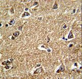 RAB13 Antibody (aa109-137)
