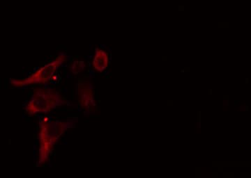Polyclonal Rabbit anti-Human B3GALTL Antibody (IHC, IF, WB)