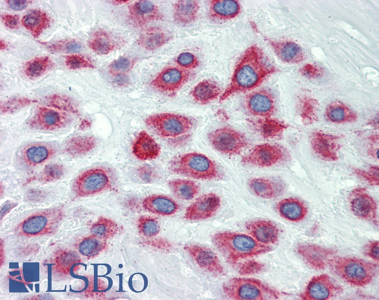 LIMD1 Antibody (N-Terminus)