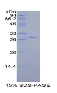 Rat SELL / L-Selectin / CD62L Protein (Recombinant His)
