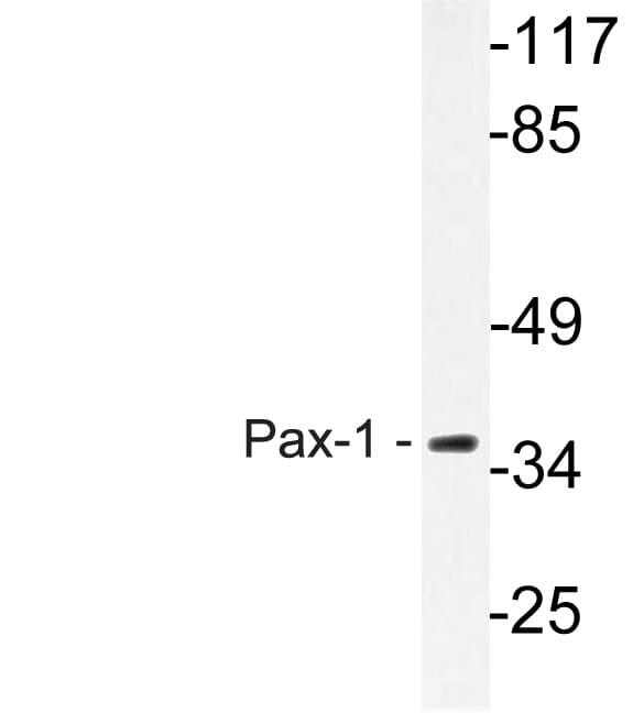 PAX1 Antibody (aa318-367)