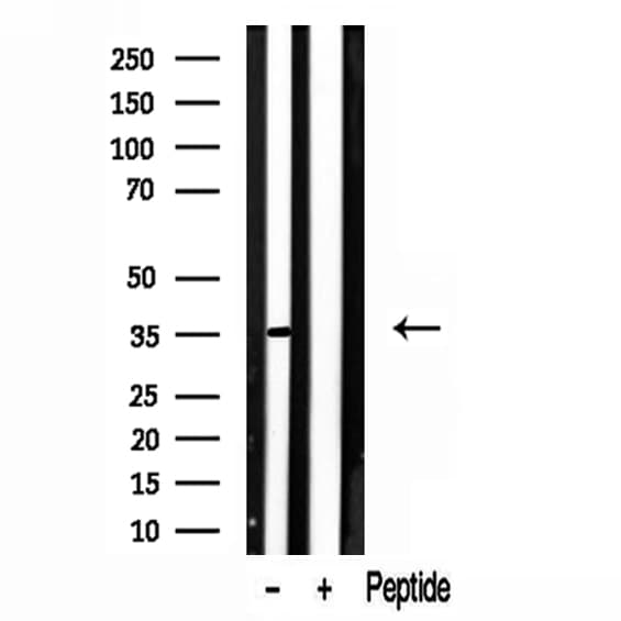 LDHB / Lactate Dehydrogenase B Antibody