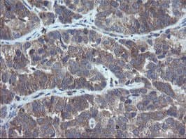 COMMD1 Antibody (clone OTI2D10)