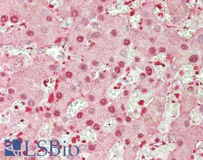 IHC-plus™ ARG2 / Arginase 2 Antibody (clone 3G5)