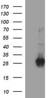 Monoclonal Mouse anti-Human CHAC1 / MGC4504 Antibody (clone OTI1E2, Carrier-free, IHC, IF, WB)