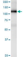 PathPlus™ PECAM-1 / CD31 Antibody (clone 1D2-1A5)
