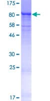 Human ZNF416 Protein (Recombinant GST)