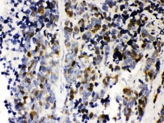 CCNA2 / Cyclin A2 Antibody