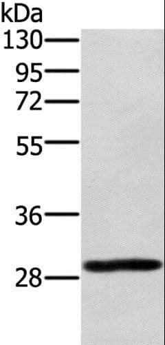 Polyclonal Rabbit anti-Human EDA2R / XEDAR Antibody (IHC, WB)