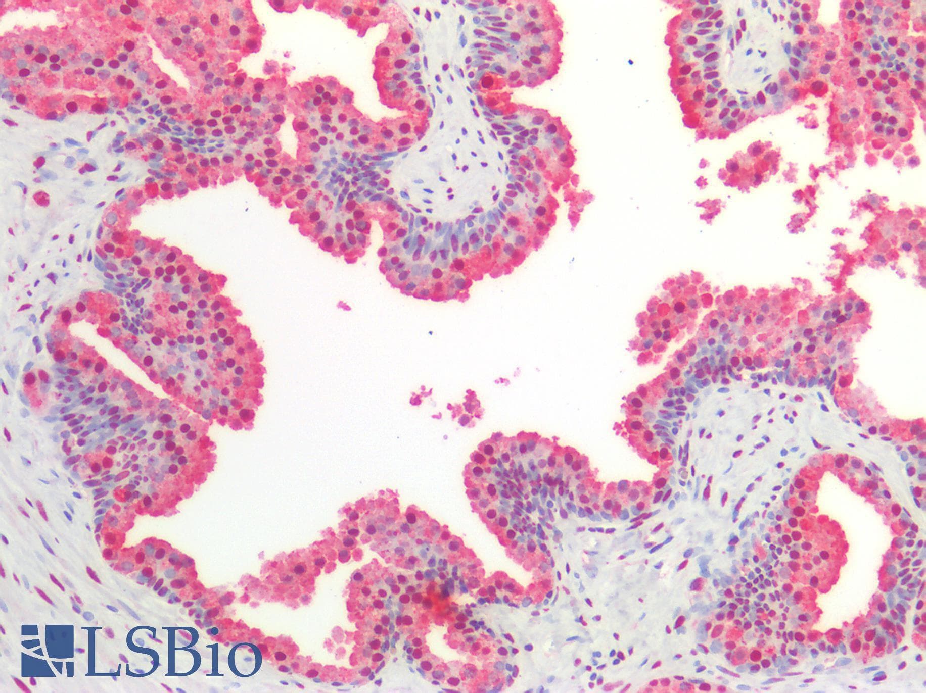 PathPlus™ Polyclonal Rabbit anti-Human BAD Antibody (IHC, WB)