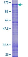 Human SNARK / NUAK2 Protein (Recombinant GST)