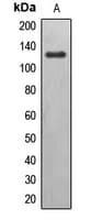 EPHB6 / EPH Receptor B6 Antibody (C-Terminus)