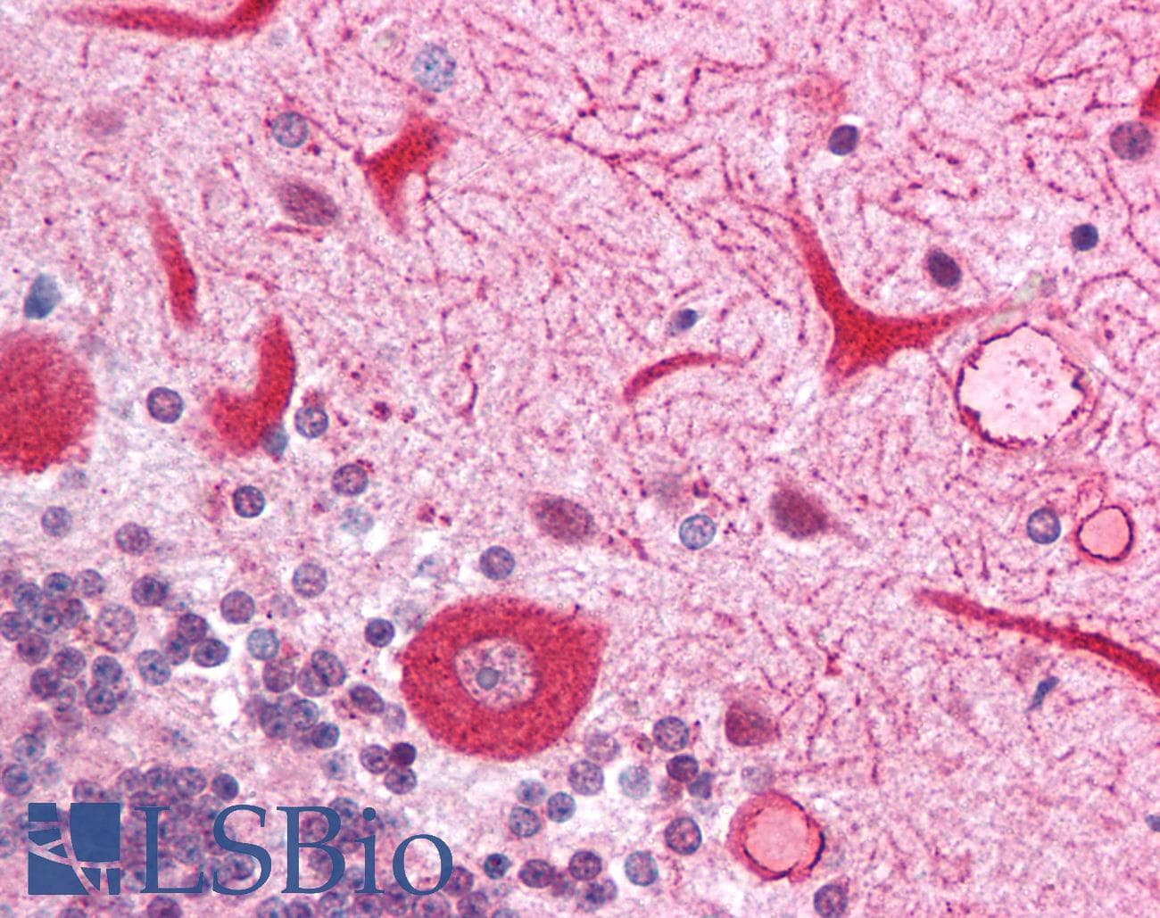 IHC-plus™ SPHK2 Antibody (N-Terminus)