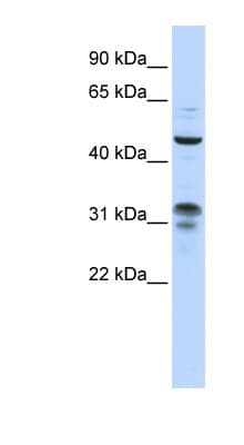 ZNF765 Antibody (aa108-157)