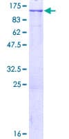 Human LONP1 / LON Protein (Recombinant GST)