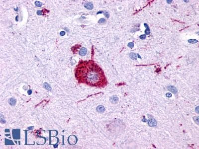 PathPlus™ Polyclonal Rabbit anti-Human ADGRF5 / GPR116 Antibody (Cytoplasmic Domain, IHC)