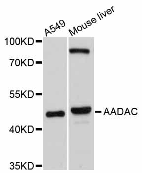 Polyclonal Rabbit anti-Human AADAC Antibody (WB)