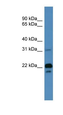 Polyclonal Rabbit anti-Human BASP1 Antibody (aa51-100, WB)