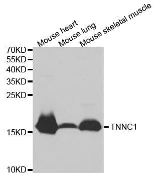 TNNC1 / Cardiac Troponin C Antibody