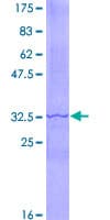 Human ADCY6 / Adenylate Cyclase 6 Protein (Recombinant GST, N-terminus)